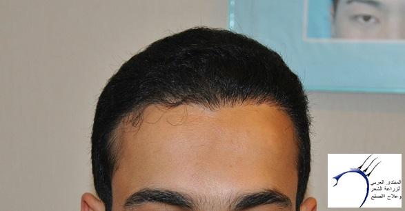 www.hairarab.comdb87fef696.jpg