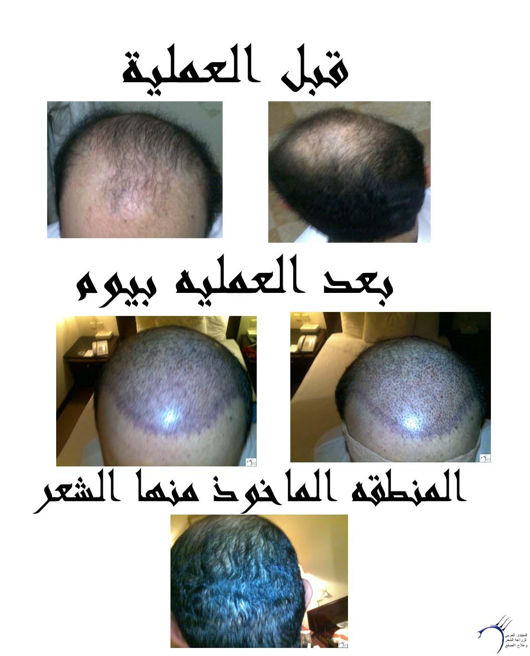 www.hairarab.comeac706a0e2.jpg