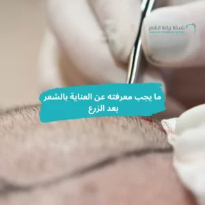 زراعة الشعر العناية بالشعر بعد الزرع