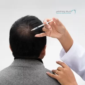 حقن راس رجل لتطويل الشعر وعلاجة