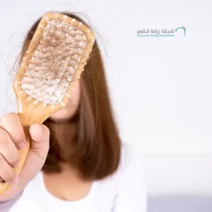 سيدة تعانى من الصلع عند النساء