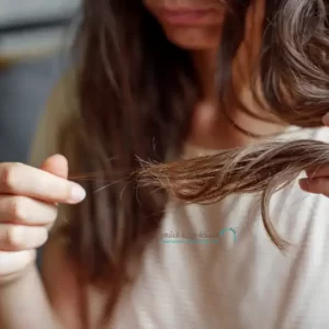 سيدة يتساقط شعرها وأدوية لمنع تساقط الشعر
