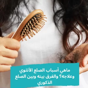 الصلع الأنثوي - الشبكة العربية لزراعة الشعر