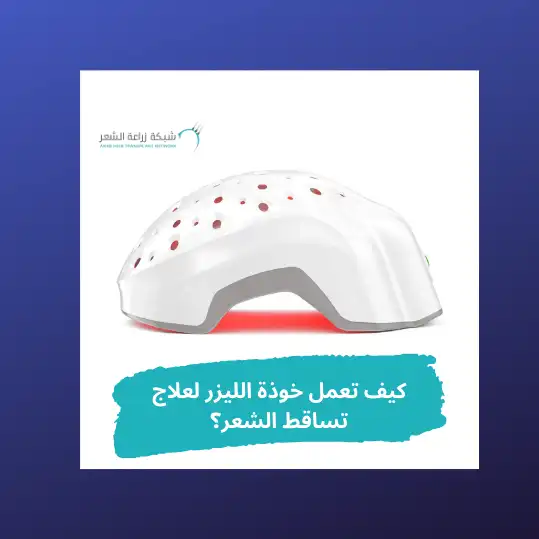 خوذة الليزر لتساقط الشعر- الشبكة العربية لزراعة الشعر