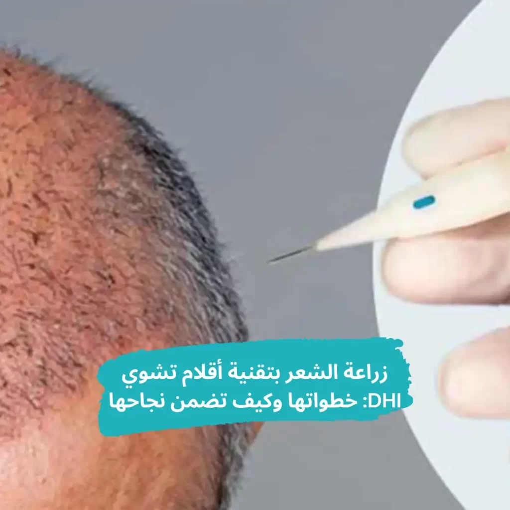 زراعة الشعر بتقنية أقلام تشوي DHI