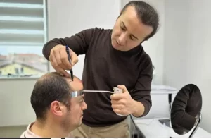 الدكتور رسول يمان يحدد راس المريض استعدادا لاجراء زراعة الشعر في مركز الدكتور يمان