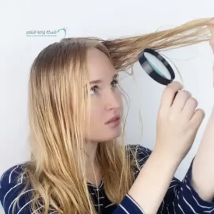 فتاة تفحص شعرها بعدسة مكبرة للتاكد من عدم وجود زهم على الشعر - الشبكة العربية لزراعة الشعر