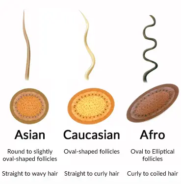 أنواع الشعر من حيث تأثير شكل البصيلة 