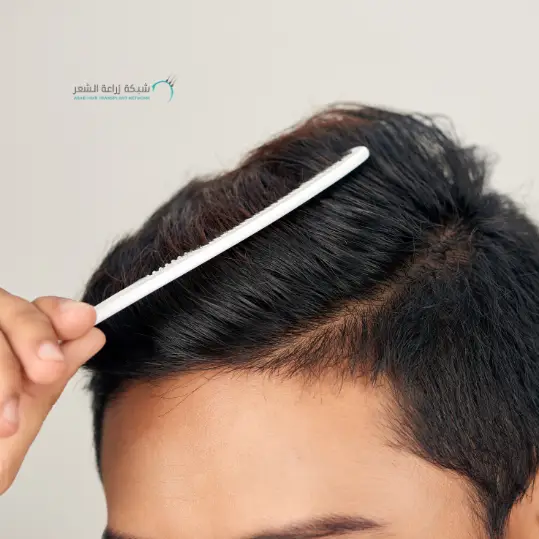 ولد يمشط شعره باستخدام مشط ابيض بعد استخدام دواء فيناسترايد لعلاج تساقط الشعر