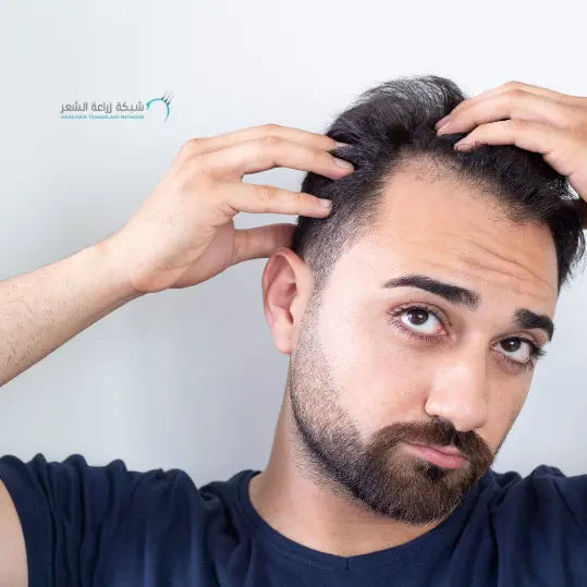 رجل يقوم بفحص شعره ليعرف معدل تساقط الشعر وتأثير التدخين وتساقط الشعر