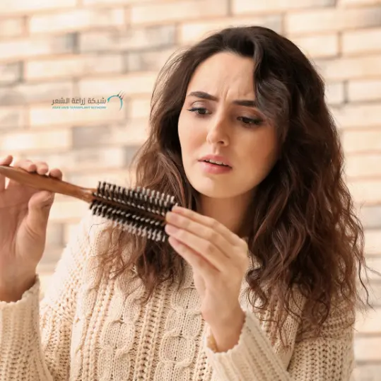 سيدة تفحص الفرشاة بعد تمشيط الشعر حيث انها تحتوى على شعر متساقط فى بداية استخدام المينوكسيديل