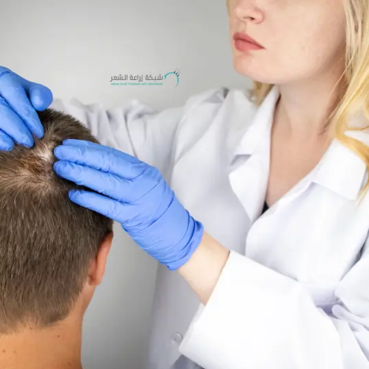 طبيبة تقوم بفحص شعر مريض لدية ثعلبة البقيعة أشهر الامراض المسببة لتساقط الشعر