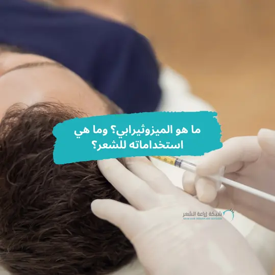 يد ترتدى قفاز طبى ابيض تقوم بحقن رأس المريض بالميزوثيرابي للشعر