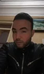 تجرتي لزراعة الشعر في مركز رويال هير بلاس بعد الزراعة بسنة ونصف