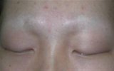 brow2 (Small) (2).jpg