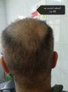 IMG_20171207_195520.jpg